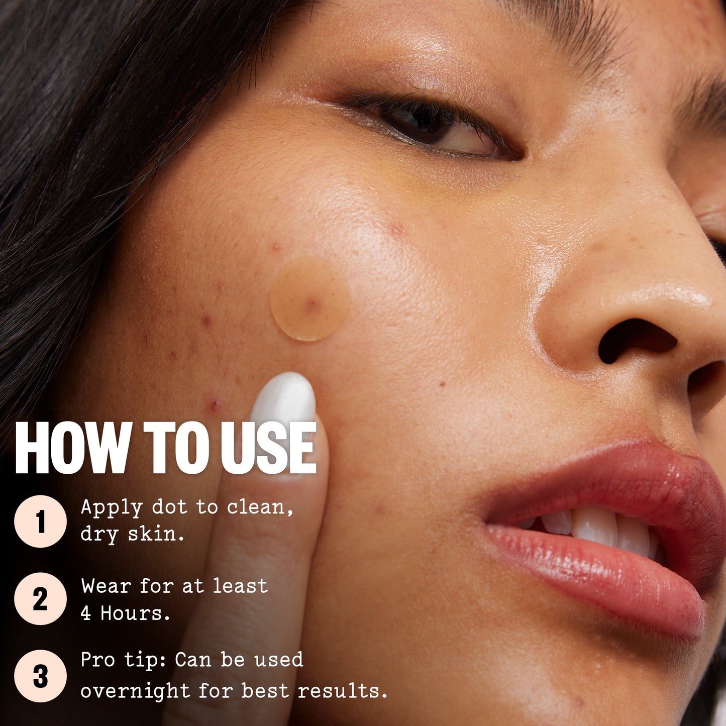 Acne Treatment Dots