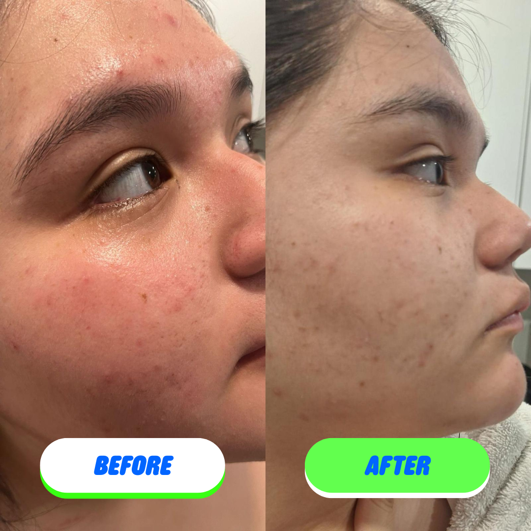 Skin Saver