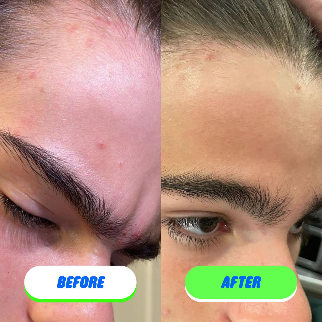 Skin Saver