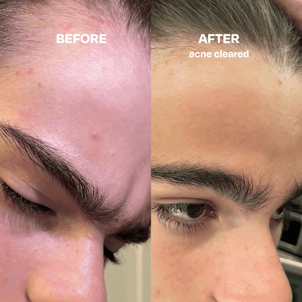 Skin Saver