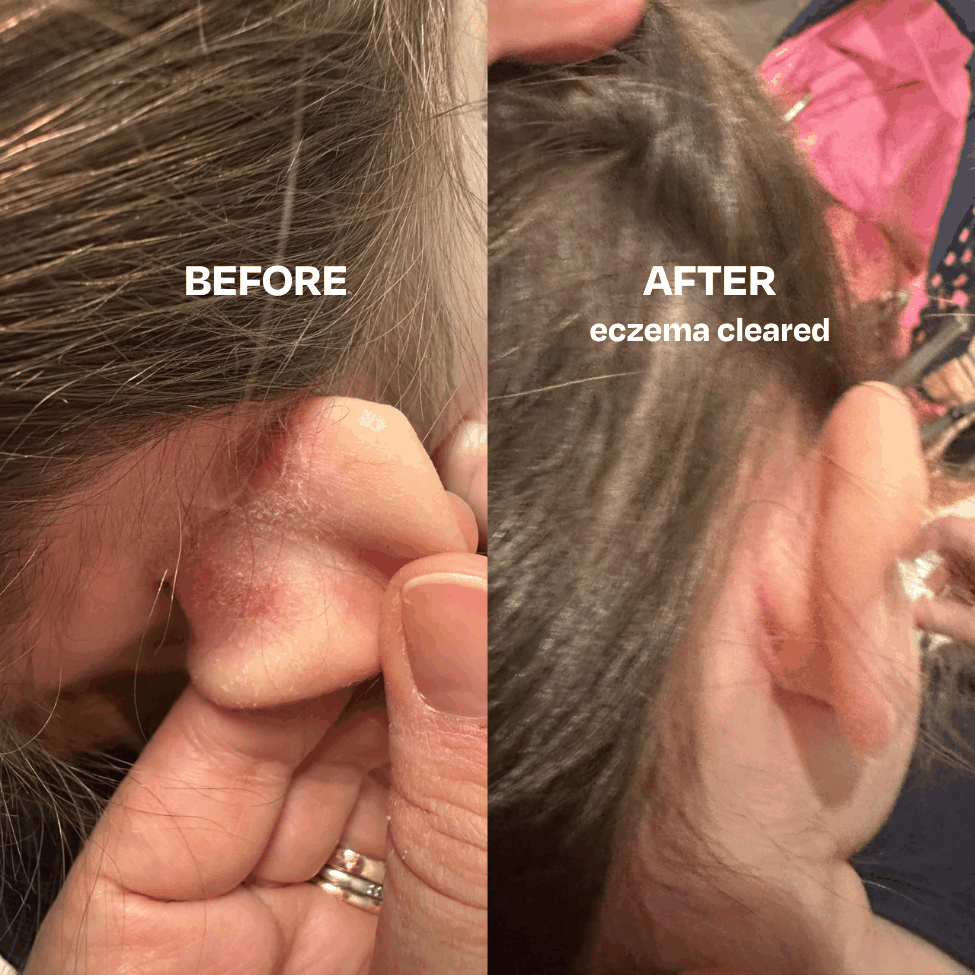 Skin Saver