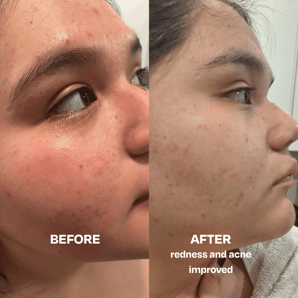 Skin Saver